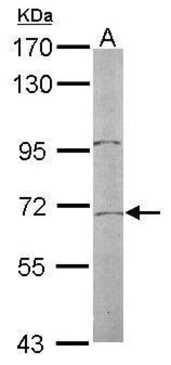 Invitrogen TR2 Polyclonal Antibody 100 &mu;L; Unconjugated:Antibodies,