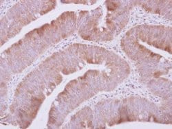 Invitrogen QARS Polyclonal Antibody 100 μL; Unconjugated:Antibodies,