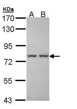 Invitrogen ALS Polyclonal Antibody 100 &mu;L | Buy Online | Invitrogen&trade; | Fisher Scientific