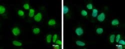 Invitrogen BTBD10 Polyclonal Antibody 100 &mu;L; Unconjugated:Antibodies,