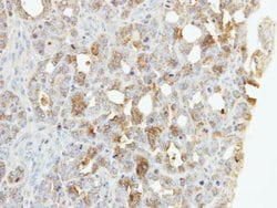 Invitrogen ZNF223 Polyclonal Antibody 100 &mu;L | Buy Online | Invitrogen&trade; | Fisher Scientific