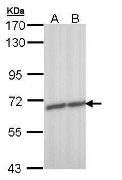 Invitrogen ZNF223 Polyclonal Antibody 100 &mu;L | Buy Online | Invitrogen&trade; | Fisher Scientific