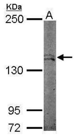 Invitrogen STK36 Polyclonal Antibody 100 &mu;L; Unconjugated:Antibodies,