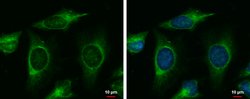 Invitrogen MINK1 Polyclonal Antibody 100 &mu;L; Unconjugated:Antibodies,