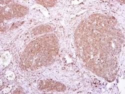 Invitrogen LILRA3 Polyclonal Antibody 100 μL; Unconjugated:Antibodies,