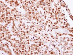 DNA ligase IV Polyclonal Antibody, Invitrogen 100 &mu;L; Unconjugated:Antibodies,