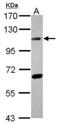 DNA ligase IV Polyclonal Antibody, Invitrogen 100 &mu;L; Unconjugated:Antibodies,