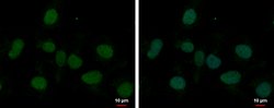 Invitrogen MED8 Polyclonal Antibody 100 &mu;L; Unconjugated:Antibodies,
