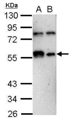 KLF12 Polyclonal Antibody:Antibodies, Polyclonal
