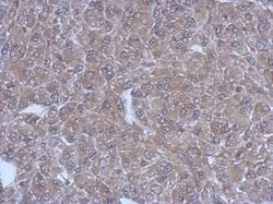 Invitrogen Bestrophin 1 Polyclonal Antibody 100 &mu;L; Unconjugated:Antibodies,