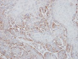 STK33 Polyclonal Antibody:Antibodies, Polyclonal