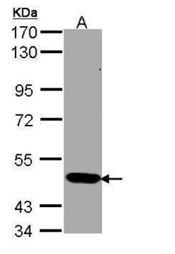 STK33 Polyclonal Antibody:Antibodies, Polyclonal