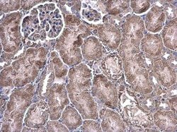 Invitrogen GRB14 Polyclonal Antibody 100 &mu;L; Unconjugated:Antibodies,