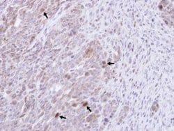 Invitrogen GRB14 Polyclonal Antibody 100 &mu;L; Unconjugated:Antibodies,