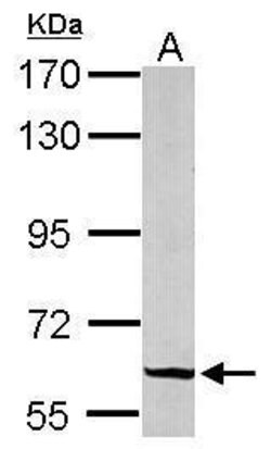 Invitrogen GRB14 Polyclonal Antibody 100 &mu;L; Unconjugated:Antibodies,