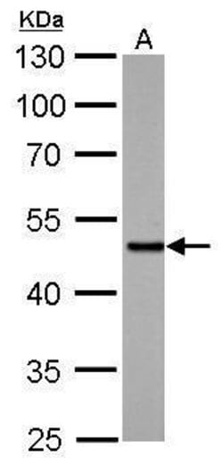 Invitrogen SMAD5 Polyclonal Antibody 100 &mu;L | Buy Online | Invitrogen&trade; | Fisher Scientific