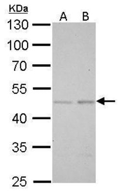 Invitrogen SMAD5 Polyclonal Antibody 100 &mu;L | Buy Online | Invitrogen&trade; | Fisher Scientific