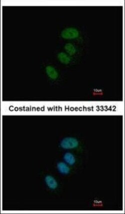 Invitrogen XPD Polyclonal Antibody 100 &mu;L; Unconjugated:Antibodies,