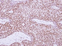 Invitrogen XPD Polyclonal Antibody 100 &mu;L; Unconjugated:Antibodies,