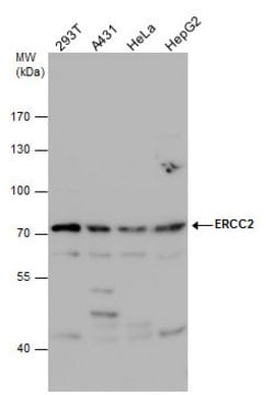Invitrogen XPD Polyclonal Antibody 100 &mu;L; Unconjugated:Antibodies,