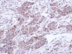 Invitrogen TNIP2 Polyclonal Antibody 100 &mu;L; Unconjugated:Antibodies,