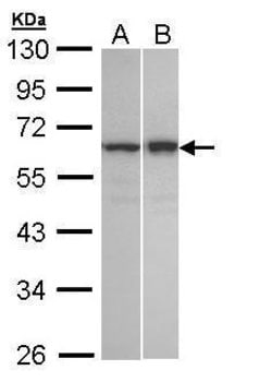 Invitrogen TNIP2 Polyclonal Antibody 100 &mu;L; Unconjugated:Antibodies,