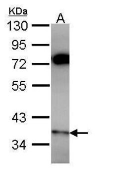 PPP6C Polyclonal Antibody:Antibodies, Polyclonal