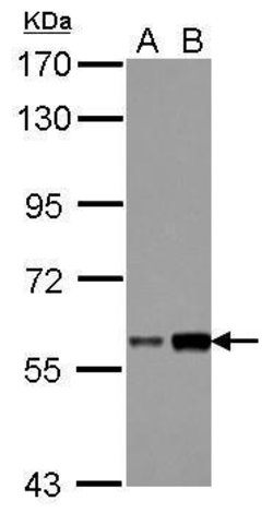 Invitrogen DKC1 Polyclonal Antibody 100 &mu;L; Unconjugated:Antibodies,