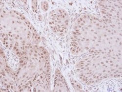 Invitrogen GTF2E2 Polyclonal Antibody 100 &mu;L; Unconjugated:Antibodies,