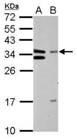 Invitrogen GTF2E2 Polyclonal Antibody 100 &mu;L; Unconjugated:Antibodies,