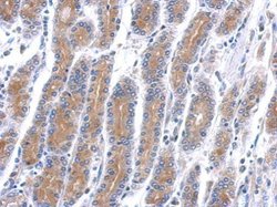 Invitrogen HSD17B6 Polyclonal Antibody 100 &mu;L; Unconjugated:Antibodies,