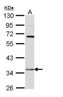 Invitrogen HSD17B6 Polyclonal Antibody 100 &mu;L; Unconjugated:Antibodies,