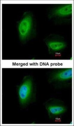 Invitrogen p73 Polyclonal Antibody 100 &mu;L; Unconjugated:Antibodies,