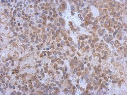 Invitrogen GP130 Polyclonal Antibody 100 &mu;L | Buy Online | Invitrogen&trade; | Fisher Scientific