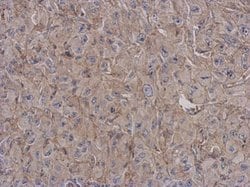Invitrogen CD180 Polyclonal Antibody 100 &mu;L; Unconjugated:Antibodies,