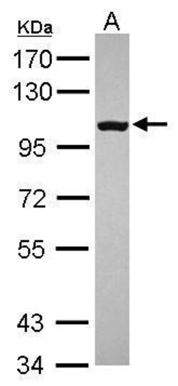 Invitrogen CD180 Polyclonal Antibody 100 &mu;L; Unconjugated:Antibodies,