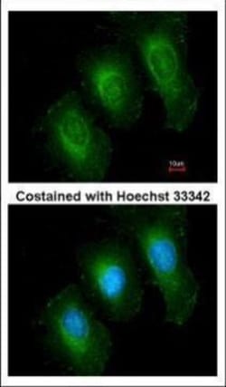Invitrogen 14-3-3 epsilon Polyclonal Antibody 100 &mu;L; Unconjugated:Antibodies,