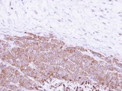 Invitrogen GGH Polyclonal Antibody 100 &mu;L | Buy Online | Invitrogen&trade; | Fisher Scientific
