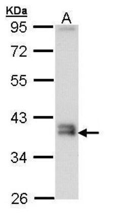 Invitrogen GGH Polyclonal Antibody 100 &mu;L | Buy Online | Invitrogen&trade; | Fisher Scientific