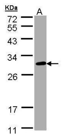 Invitrogen CHIC2 Polyclonal Antibody 100 &mu;L | Buy Online | Invitrogen&trade; | Fisher Scientific
