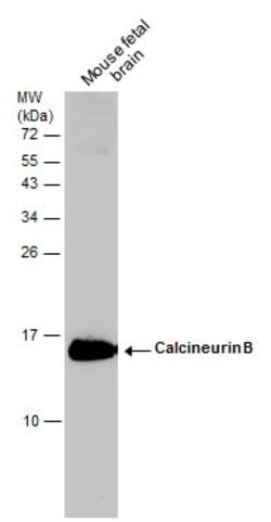 Invitrogen Calcineurin B Polyclonal Antibody 100 &mu;L; Unconjugated:Antibodies,
