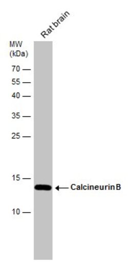 Invitrogen Calcineurin B Polyclonal Antibody 100 &mu;L; Unconjugated:Antibodies,