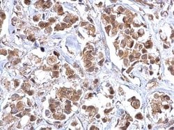 Invitrogen Bcl-10 Polyclonal Antibody 100 &mu;L; Unconjugated:Antibodies,