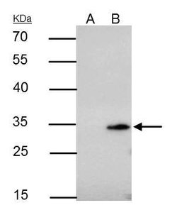 Invitrogen Bcl-10 Polyclonal Antibody 100 &mu;L; Unconjugated:Antibodies,