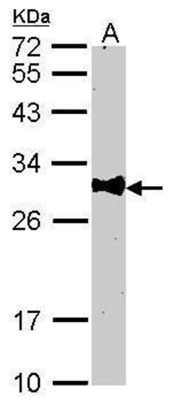 Invitrogen Bcl-10 Polyclonal Antibody 100 &mu;L; Unconjugated:Antibodies,