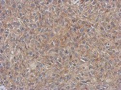 Invitrogen 4EBP1 Polyclonal Antibody 100 &mu;L; Unconjugated:Antibodies,