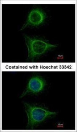Invitrogen SBDS Polyclonal Antibody 100 &mu;L; Unconjugated:Anticorps,