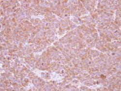 Invitrogen SBDS Polyclonal Antibody 100 &mu;L; Unconjugated:Anticorps,