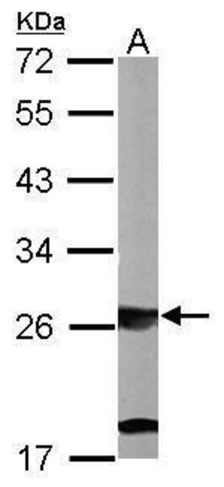 Invitrogen SBDS Polyclonal Antibody 100 &mu;L; Unconjugated:Anticorps,