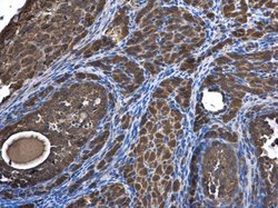 Invitrogen SAR1B Polyclonal Antibody 100 &mu;L | Buy Online | Invitrogen&trade; | Fisher Scientific